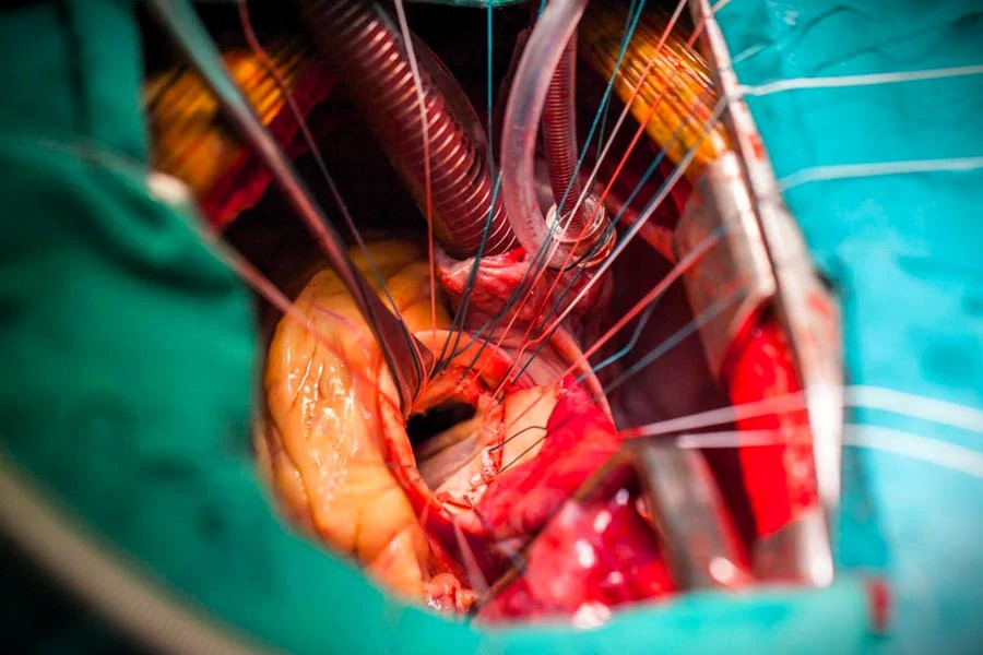 Bharat Vikas Parishad Hospital and Reserch Center