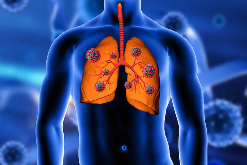 Bharat Vikas Parishad Hospital and Reserch Center